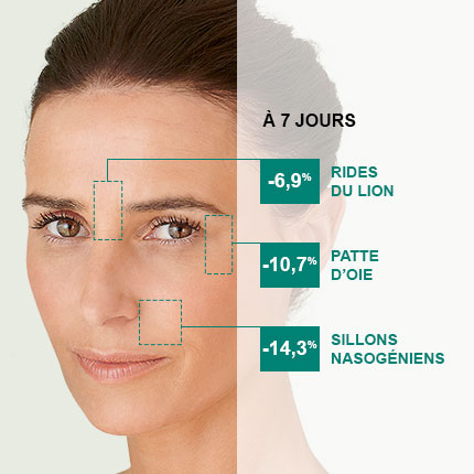 Crème anti-rides comblantes